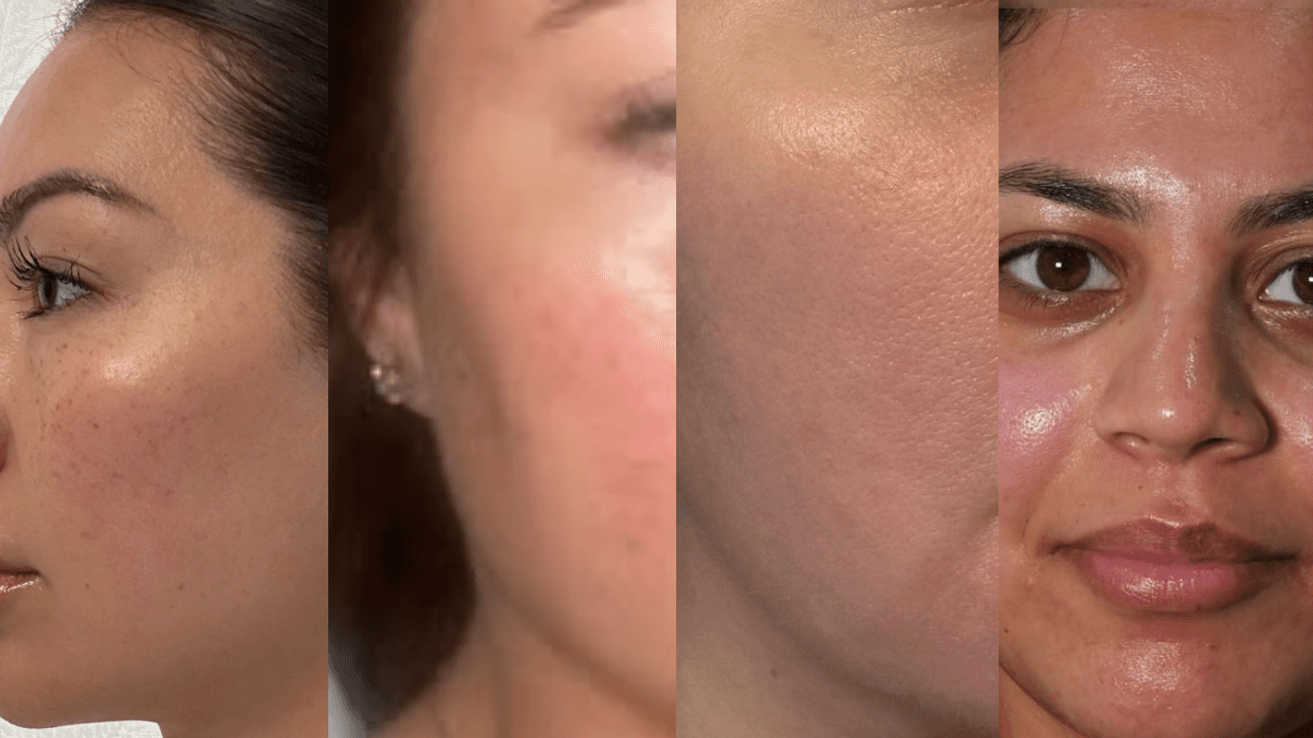 Facial Rejuvination & Korean Glass Skin after